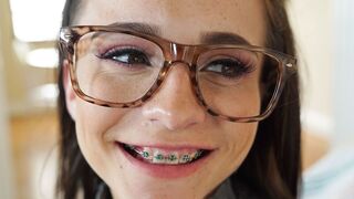 Teen Porn Braces